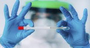 Reportan 183 contagios nuevos y un fallecimiento por Covid-19