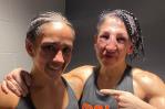 Así quedó el rostro de la boxeadora que recibió 236 golpes Así quedó el rostro de la boxeadora que recibió 236 golpes