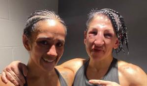 Así quedó el rostro de la boxeadora que recibió 236 golpes