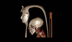 Investigadores egipcios descubren secretos de una momia sin retirarle las vendas