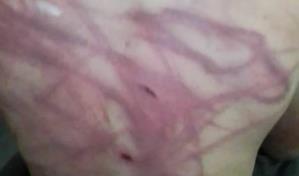 Apresan hombre por golpear hijo con cable de freno de bicicleta