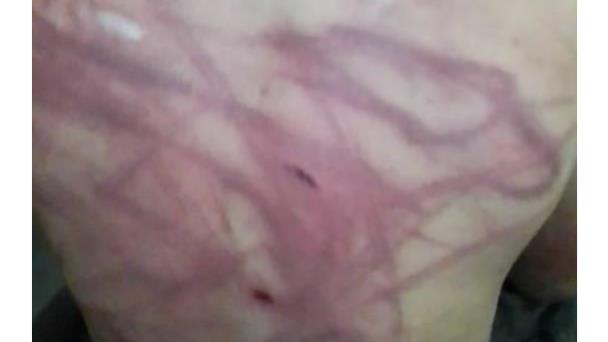 Apresan hombre por golpear hijo con cable de freno de bicicleta