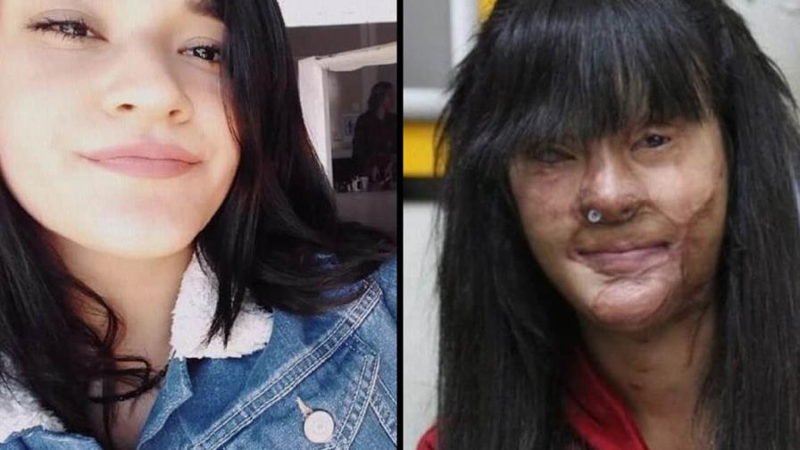 Él le desfiguró la cara: ella lo perdonó y le juró amor eterno Él le desfiguró la cara: ella lo perdonó y le juró amor eterno