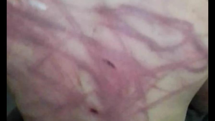 Dictan prisión preventiva a padre golpeó hijo con cable de bicicleta en Montecristi Dictan prisión preventiva a padre golpeó hijo con cable de bicicleta en Montecristi