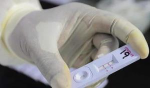 Salud Pública empieza trámites para que farmacias vendan test de COVID-19