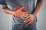 Cirrosis hepática, una enfermedad mortal ampliamente desconocida