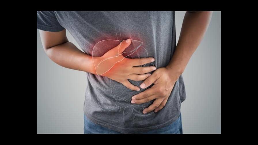 Cirrosis hepática, una enfermedad mortal ampliamente desconocida