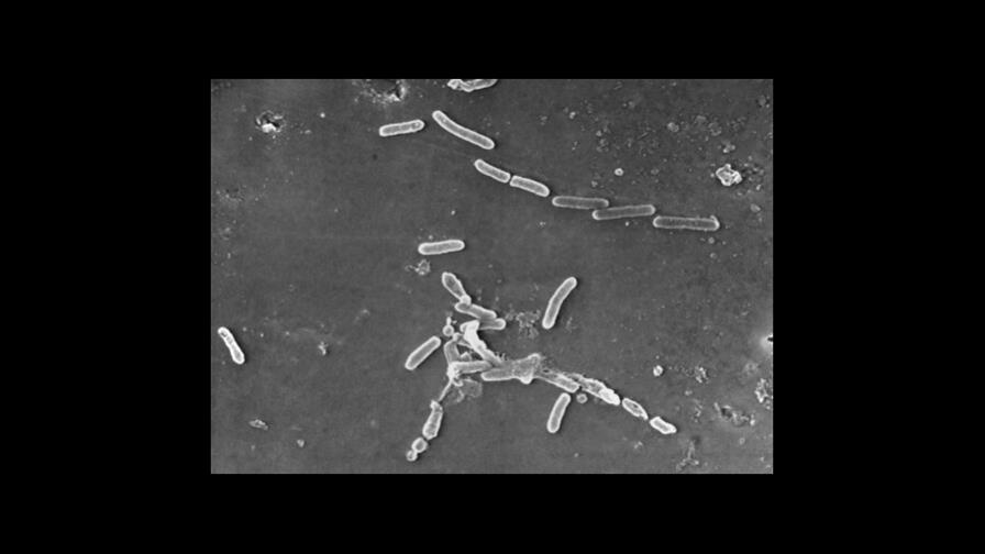 Superbacterias causan más de 1.2 millones de muertes