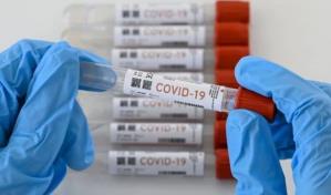 Joven con VIH sufre de COVID-19 durante 9 meses y desarrolla 21 mutaciones