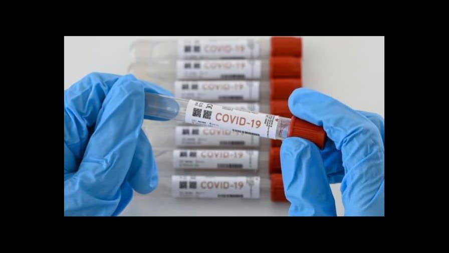 Joven con VIH sufre de COVID-19 durante 9 meses y desarrolla 21 mutaciones Joven con VIH sufre de COVID-19 durante 9 meses y desarrolla 21 mutaciones