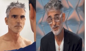 Así luce el rostro de Miguel Varoni tras sus retoques estéticos