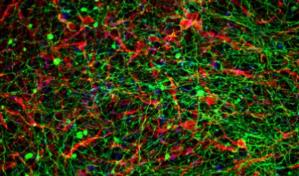 Estudio israelí busca revertir la parálisis con implantes de médula espinal