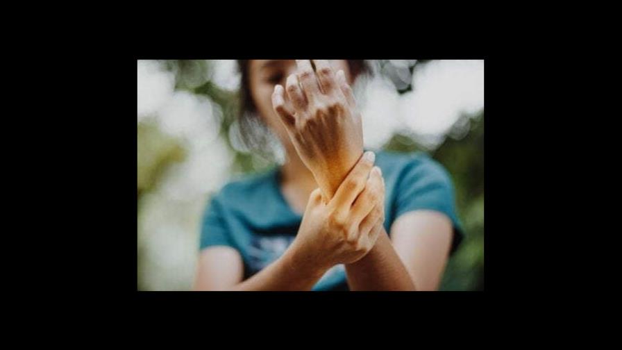 Mano ajena: de qué se trata este extraño síndrome Mano ajena: de qué se trata este extraño síndrome