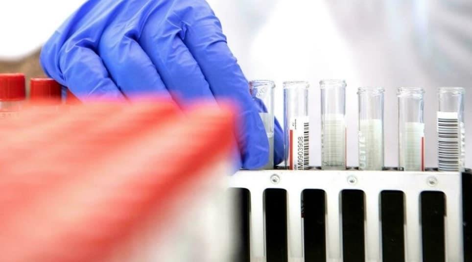 Científicos chinos presentan nuevo test anticovid ultrarrápido