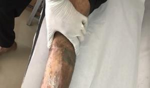 Piden ir en auxilio de los presos con enfermedades terminales en el país