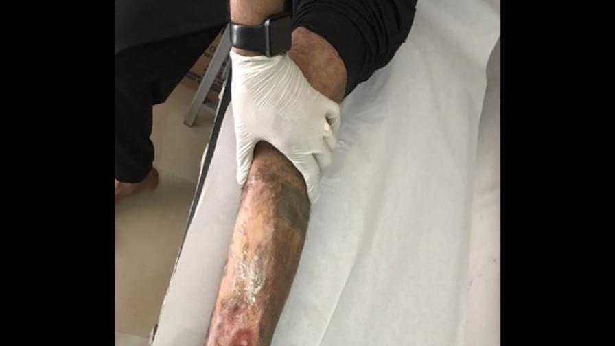 Piden ir en auxilio de los presos con enfermedades terminales en el país