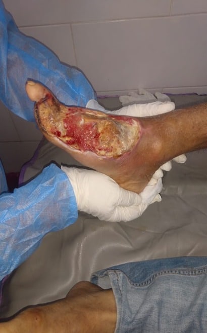 Un preso con una enfermedad en un recinto carcelario 