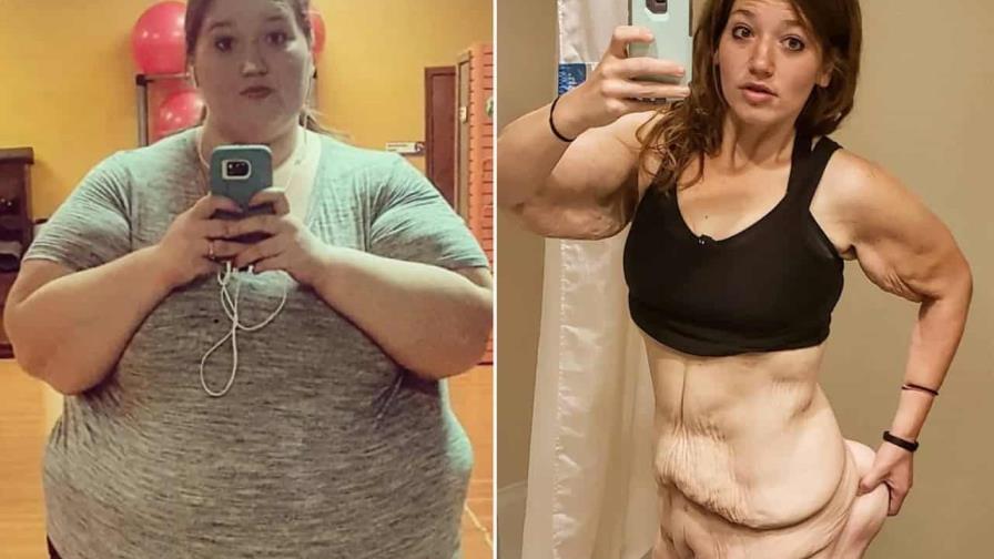 Influencer Lexi Reed estuvo en coma por insuficiencia orgánica