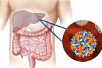 Pacientes con hepatitis C pueden durar hasta 20 años asintomáticos