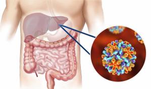 Pacientes con hepatitis C pueden durar hasta 20 a&ntilde;os asintom&aacute;ticos