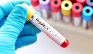 Experto asegura más del 95 % de los pacientes con hepatitis C se curan si reciben tratamiento