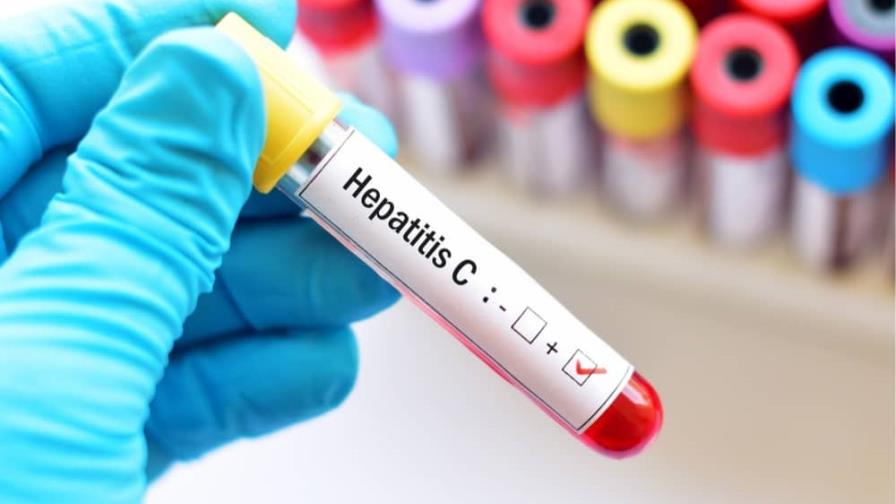 Experto asegura más del 95 % de los pacientes con hepatitis C se curan si reciben tratamiento Experto asegura más del 95 % de los pacientes con hepatitis C se curan si reciben tratamiento