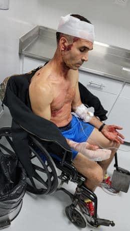 Asaltan  atleta en Boca Chica; lo hieren a machetazos