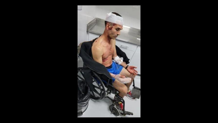 Asaltan  atleta en Boca Chica; lo hieren a machetazos