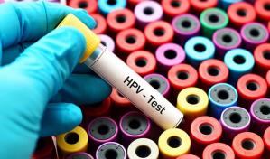 Ocho de cada 10 personas se infectarán de papiloma en algún momento de sus vidas
