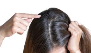 Algunas personas tienen canas desde muy jóvenes ¿Por qué?