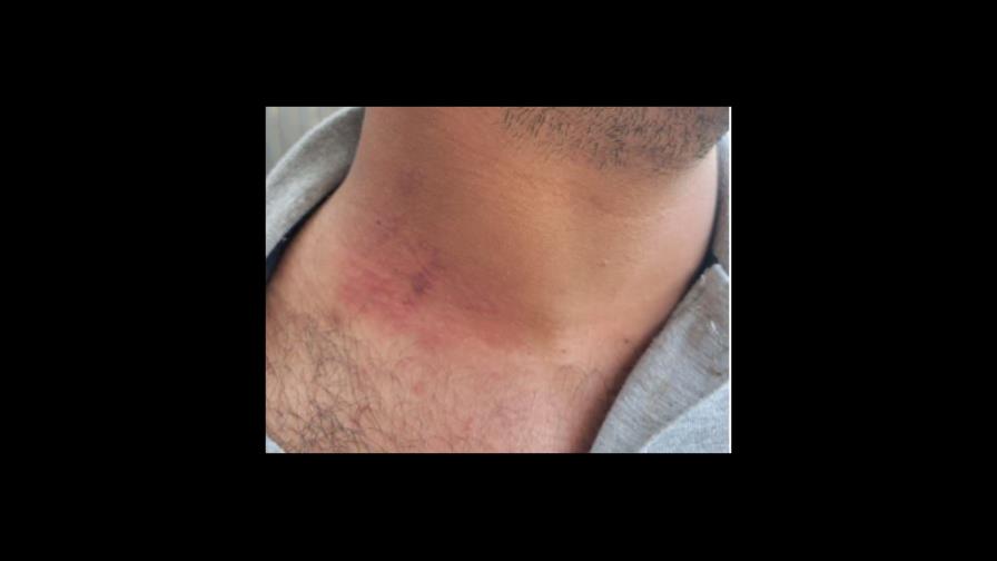 Migración niega que agentes hayan golpeado a un haitiano