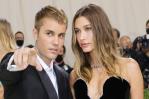 Hailey Baldwin, la esposa de Justin Bieber, sufrió accidente cerebrovascular