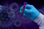 Salud Pública reporta 92 nuevos casos de contagios COVID-19 y cero muertes