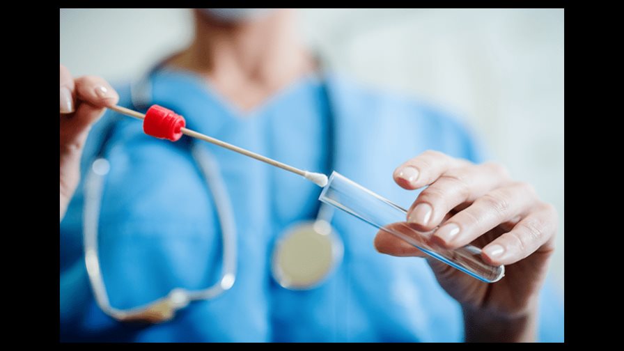Unas proteínas de la saliva podrían a ayudar a predecir la COVID grave