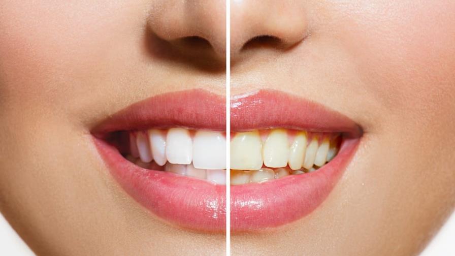 Alimentos que manchan y limpian tu dentadura Alimentos que manchan y limpian tu dentadura