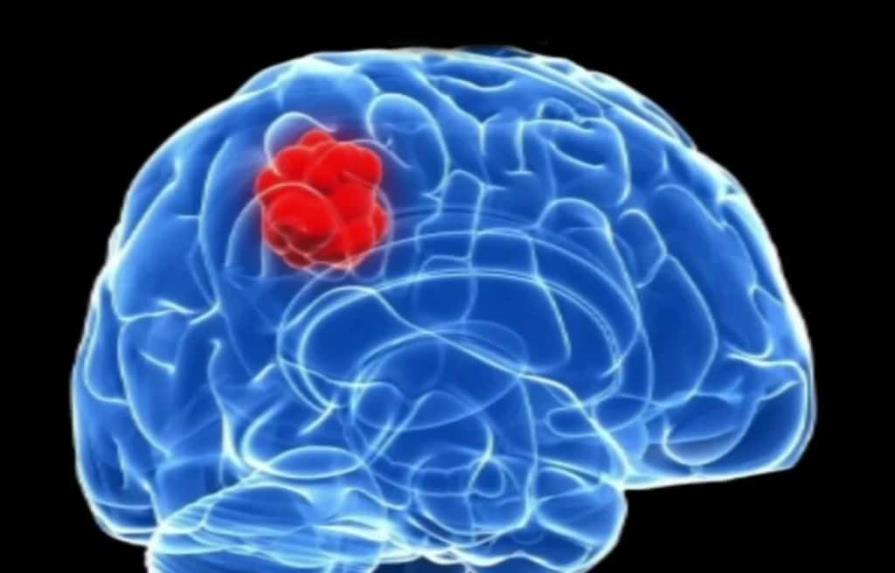 Descubren utilidad de fármacos para la hipertensión para un cáncer cerebral