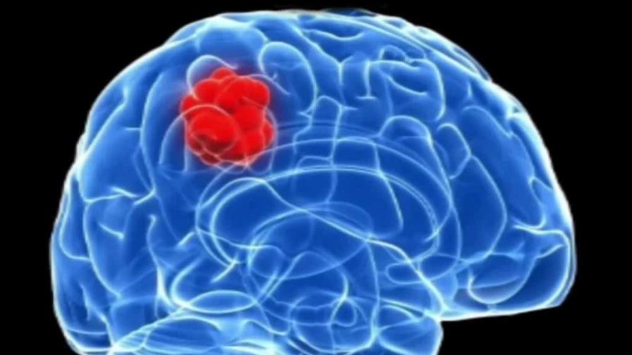 Descubren utilidad de fármacos para la hipertensión para un cáncer cerebral Descubren utilidad de fármacos para la hipertensión para un cáncer cerebral