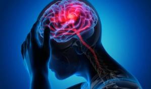 Realizarán en Semana Santa campaña que busca prevenir derrames cerebrales