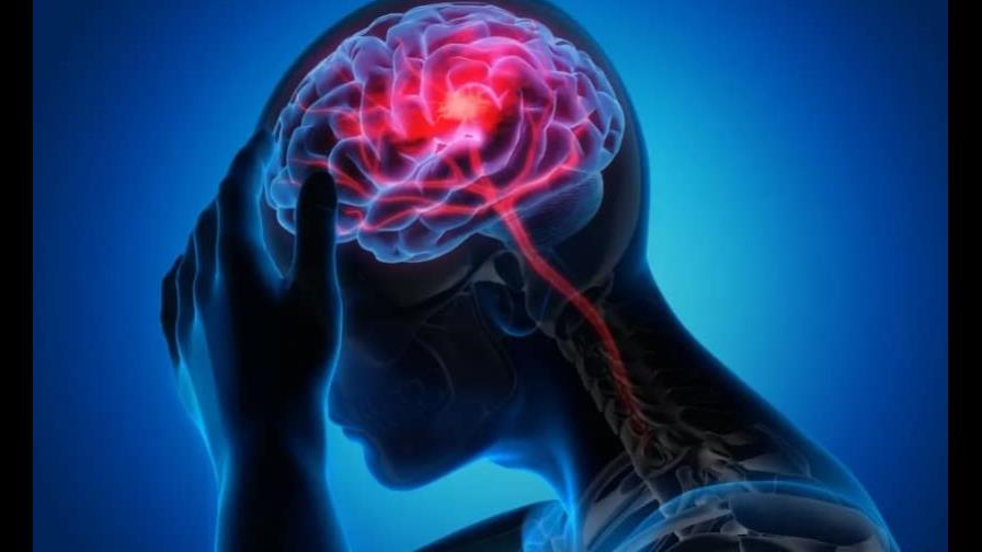 Realizarán en Semana Santa campaña que busca prevenir derrames cerebrales Realizarán en Semana Santa campaña que busca prevenir derrames cerebrales