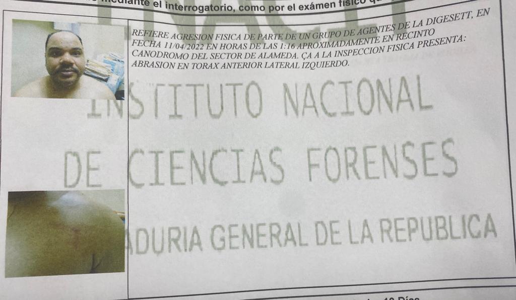 El Instituto Nacional de Ciencias forenses de la Procuraduría General de la República determinó que Pablo Ulloa presenta una abrasión en el tórax anterior lateral izquierdo.