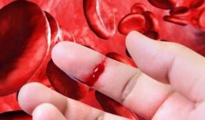 FDA aprueba la primera terapia génica para tratar a adultos con hemofilia B