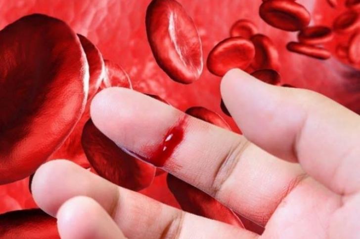 Dra. Joanne Taveras: “La hemofilia se hereda, pero también se adquiere”