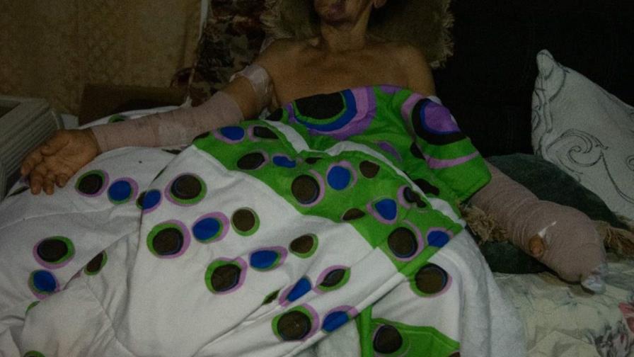 Mujer de 75 años fue agredida a machetazos en el sector Los Guandules Mujer de 75 años fue agredida a machetazos en el sector Los Guandules