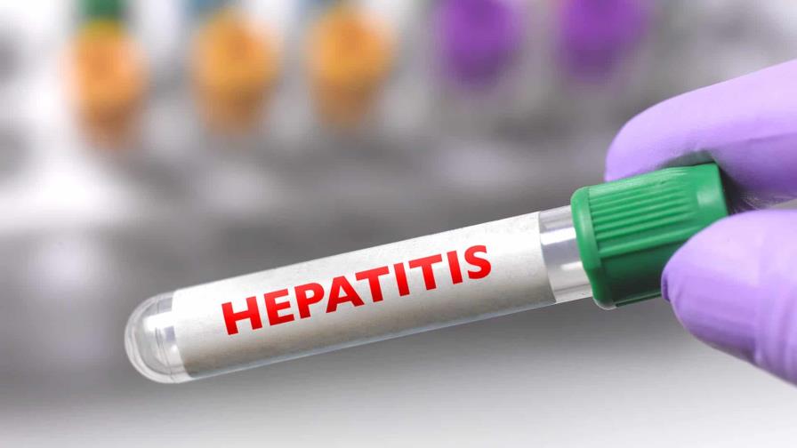 Argentina detecta el primer caso de hepatitis infantil aguda desconocida Argentina detecta el primer caso de hepatitis infantil aguda desconocida