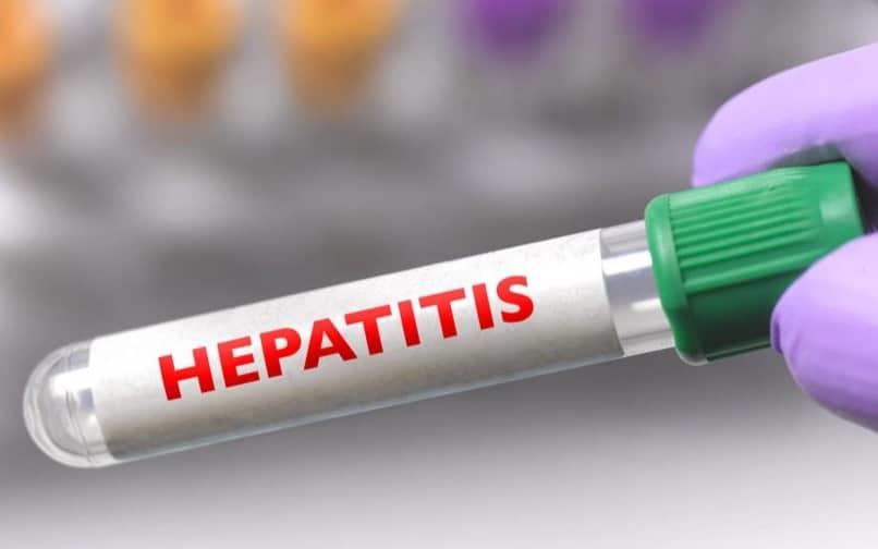 OMS eleva a 650 los casos de hepatitis infantil aguda de origen desconocido