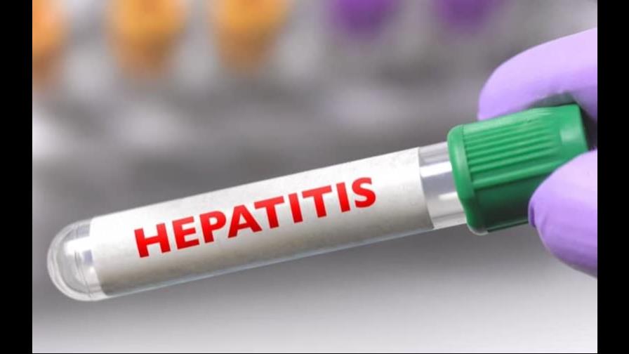 OMS eleva a 650 los casos de hepatitis infantil aguda de origen desconocido OMS eleva a 650 los casos de hepatitis infantil aguda de origen desconocido