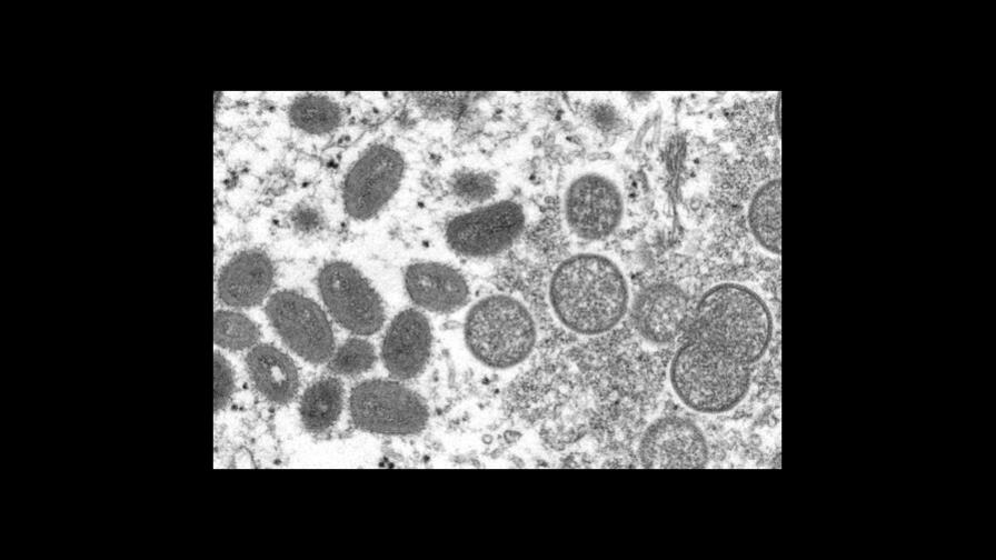 Portugal descubre cinco casos de viruela del mono en hombres