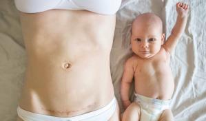 Violencia obstétrica, un tipo de maltrato normalizado