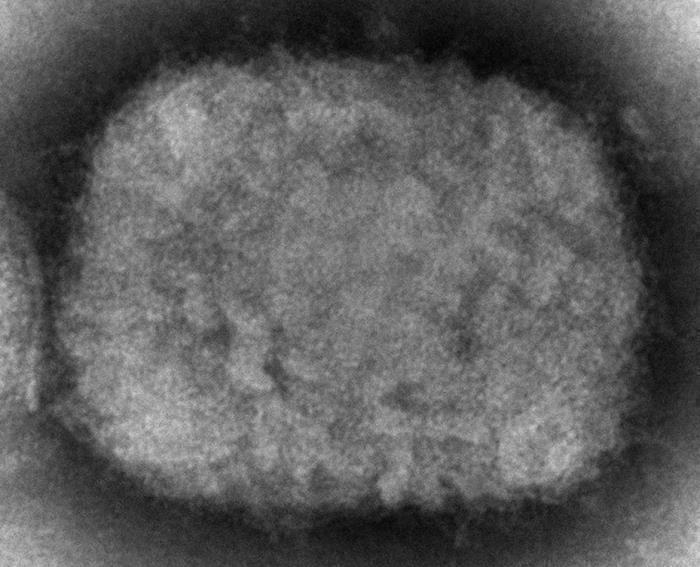 Antivirales podrían reducir la duración de los síntomas de viruela del mono