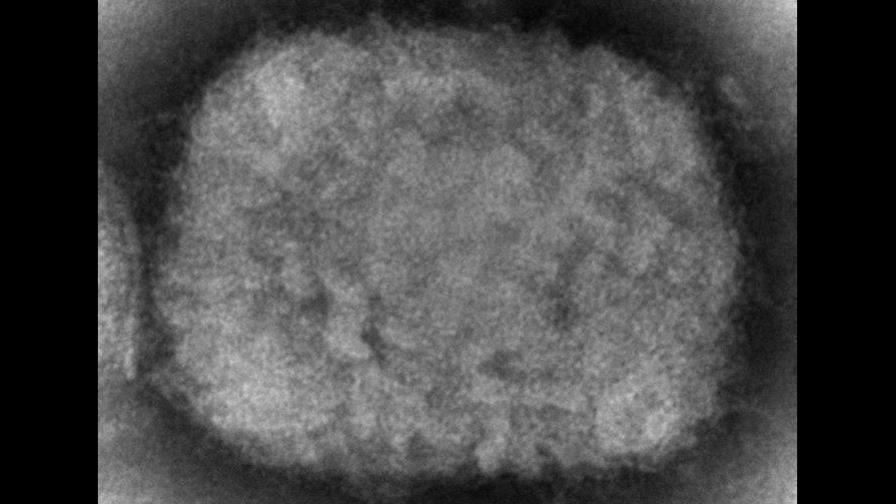 Antivirales podrían reducir la duración de los síntomas de viruela del mono Antivirales podrían reducir la duración de los síntomas de viruela del mono
